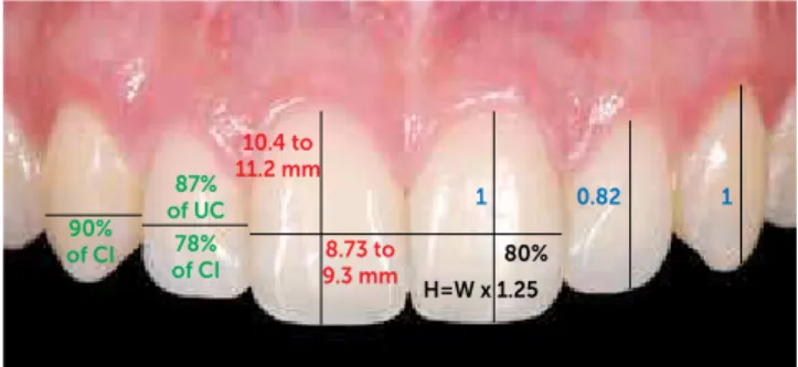 Figure 2 - Real proportions and dimensions of teeth with four approaches: 