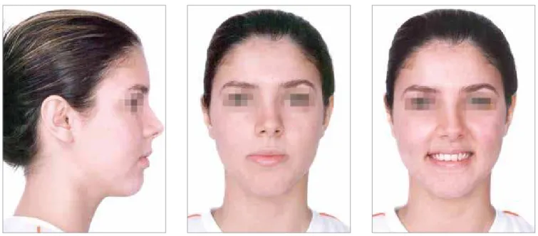 Figure 1 - Initial facial photographs.