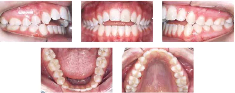 Figure 2 - Initial intraoral photographs.