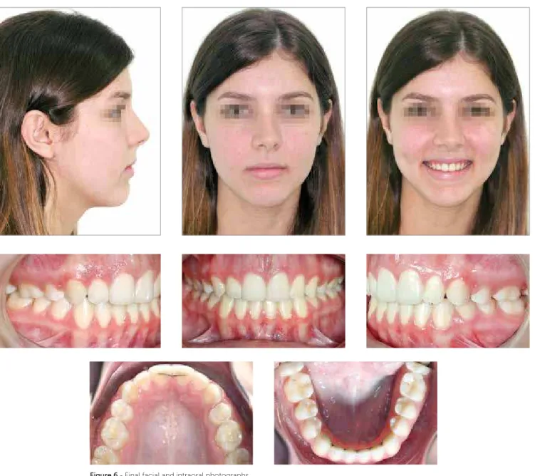 Figure 6 - Final facial and intraoral photographs.