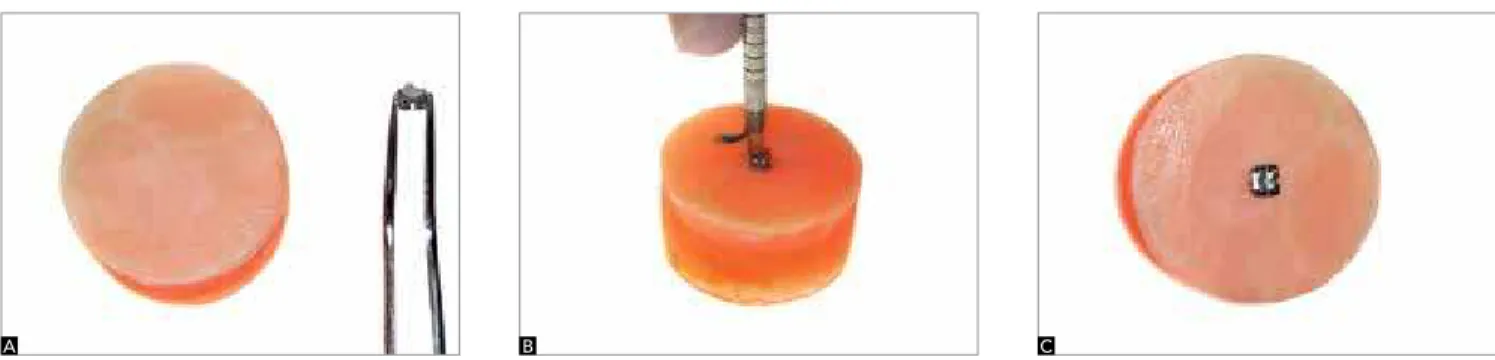 Figure 1 - Sequence of bonding, A) bonding material applied to the base of the bracket, B) pressure of 400 gF applied at the moment of bonding to standardize  the material thickness, C) specimen.