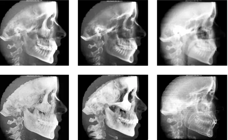 Figure 3 - Several image ilters that are provided by Dolphin 3D.