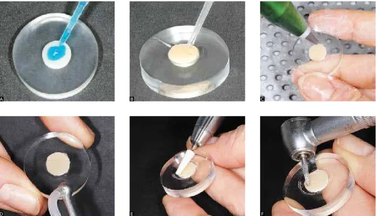 Figure 2 - Surface treatment using: A) 37% phosphoric acid, B) hydroluoric acid, C) aluminum oxide blasting, D) sodium bicarbonate blasting, E) mounted  stone, and F) diamond bur.