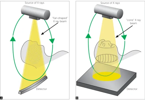 Figure 4 - Draft of projection of X-rays showing  the dif erences on the obtention of image  be-tween a simple detector (A) and the cone beam (B)