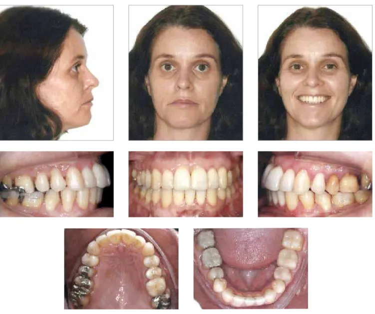 Figure 6 - Final intraoral and facial photographs.