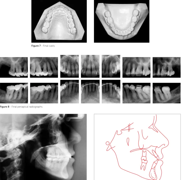 Figure 8 - Final periapical radiographs.
