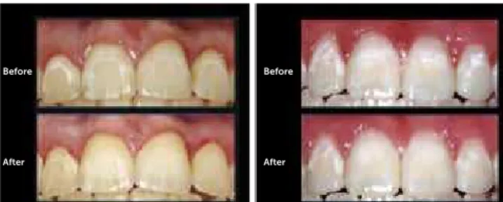 Figure 2 - Examples of photos before and after. Source:  Huang  et al, 3  2013.
