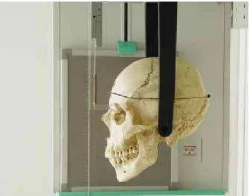 Figure 2 - Positioning the skull on the cephalostat.