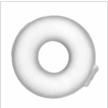 Figure 2 - Ligature prior to staining process.