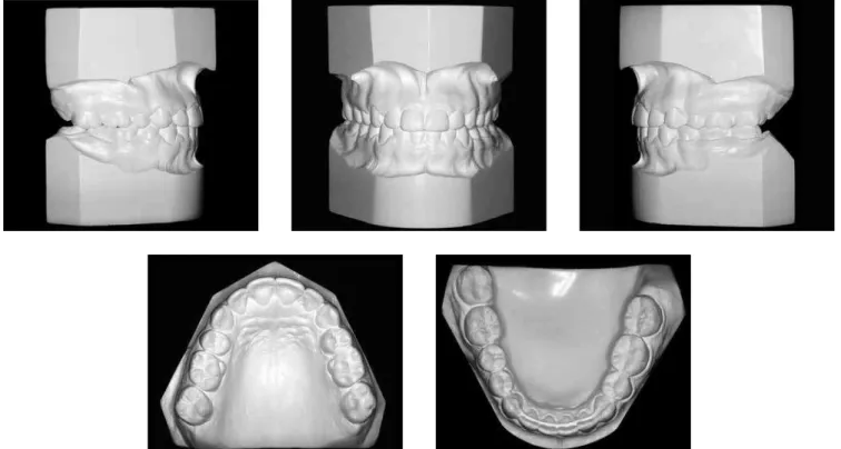 Figure 6 - Final casts.