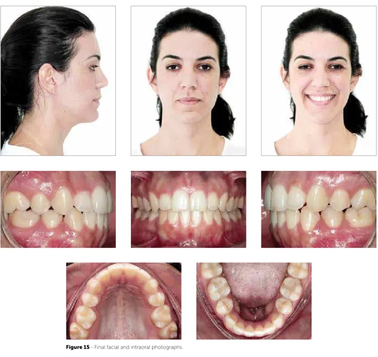 Figure 15 - Final facial and intraoral photographs. 