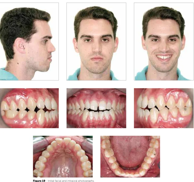 Figure 19 - Initial facial and intraoral photographs.