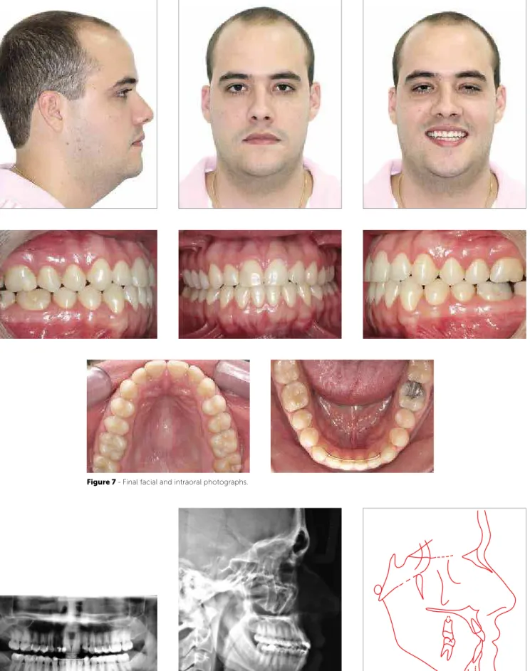 Figure 7 - Final facial and intraoral photographs. 