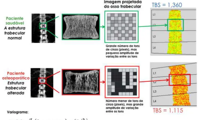 Figura 4: Princípios do escore de osso trabecular  