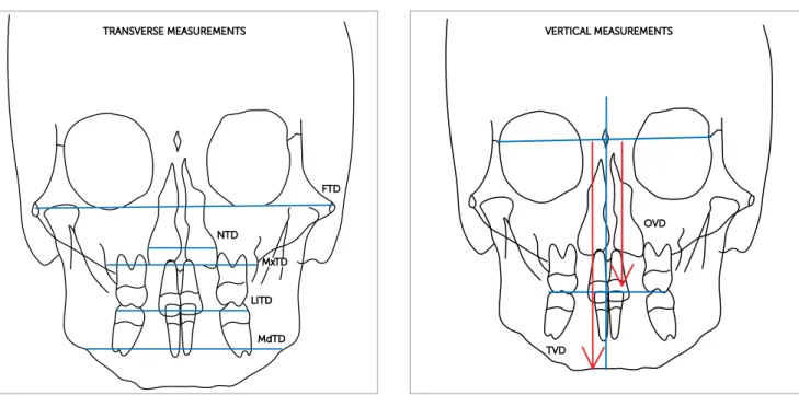 Figure 1 - Transverse measurements proposed by Ricketts. 