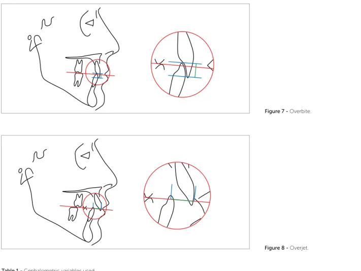 Figure 7 - Overbite.