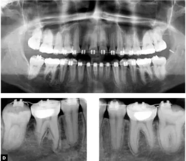 Figure 8 - Final facial and intraoral photographs.