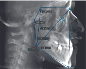 Figure 1 - Example of CBCT cephalogram used in this study.
