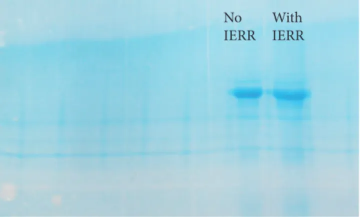 Figure 5 - One-dimensional 12% SDS-PAGE gel. Protein extraction by means  of sodium phosphate buffer solution stained with Coomassie G-250 blue