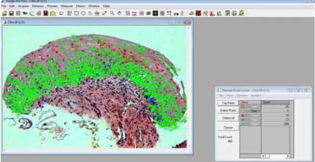 Figura  1:  Avaliação  histomorfométrica  processada  no  programa  Image  Pro  Plus  versão  4.5  – HE, 40x