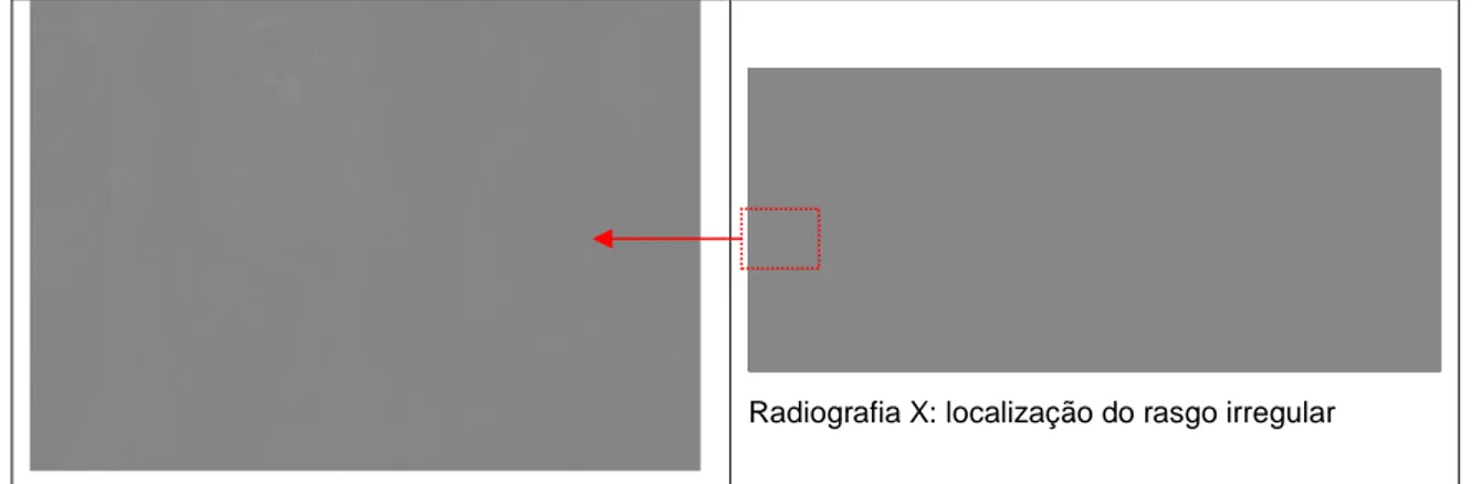 FIGURA  13-  Radiografia  X:  detalhe  do  rasgo  de  formato  irregular  localizado  na  lateral  inferior à esquerda da tela