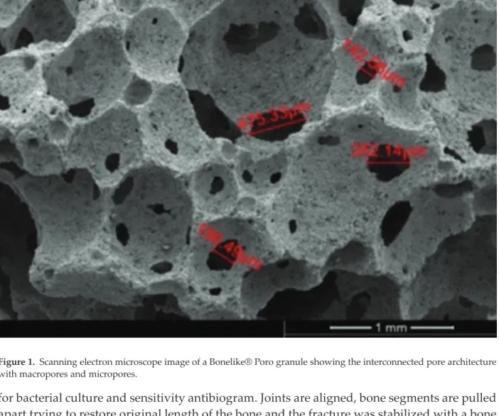 Figure 1. Scanning electron microscope image of a Bonelike® Poro granule showing the interconnected pore architecture with macropores and micropores.