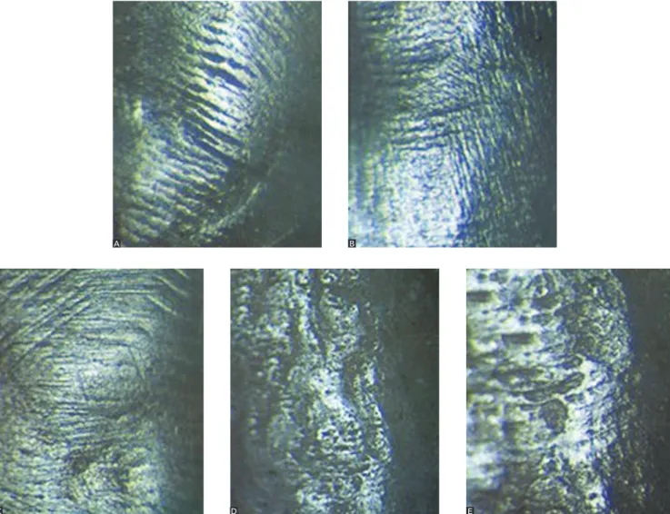 Figure 1 - Digital photographs (100 x) for ESI classification: A) Score 0; B) Score 1; C) Score 2; D) Score 3; and E) Score 4.