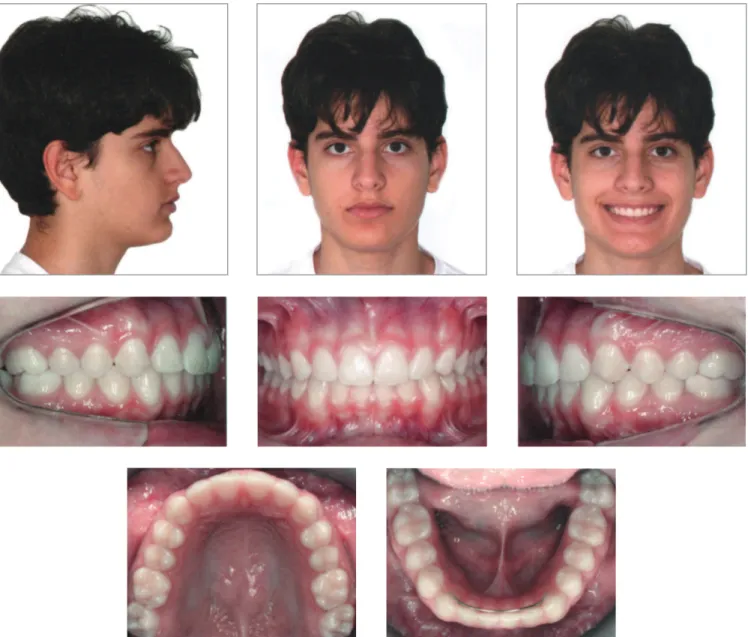 Figure 7 - Final facial and intraoral photographs.