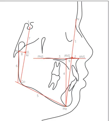 Figure 1 - Cephalometric landmarks, lines and planes.