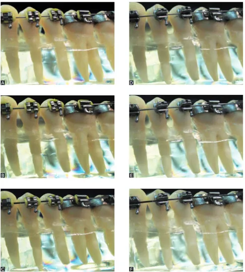 Figure 2 - A,  B, C) Conventional brackets; 