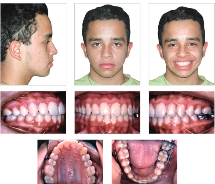 Figure 8 - Final facial and intraoral photographs.