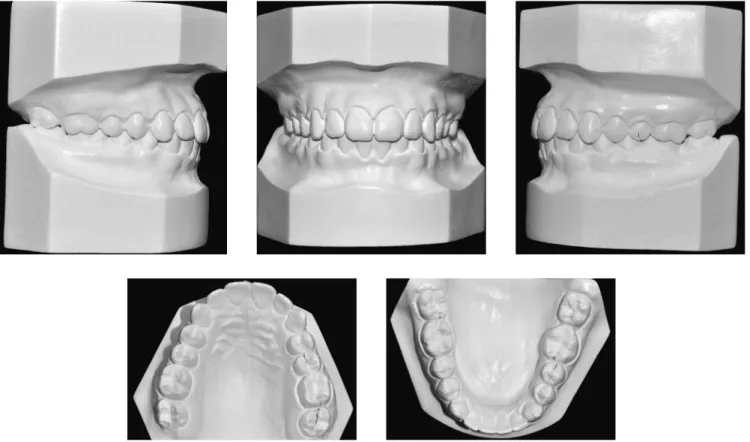 Figure 9 - Final casts.