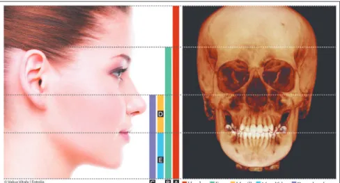 Figure 2 -  Cone-beam computed tomography  field of view: It is cylindrical and determined  ac-cording to its vertical extent