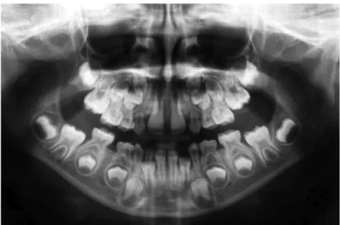 Figure 3 - Initial panoramic radiograph.