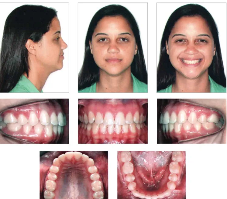 Figure 11 - Final facial and intraoral photographs.