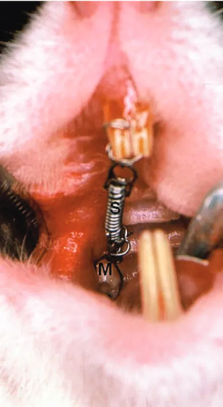 Figure 1 - Occlusal view of orthodontic appliance placed on rat upper right  first molar