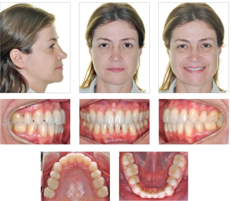 Figure 7 - Final facial and intraoral photographs.