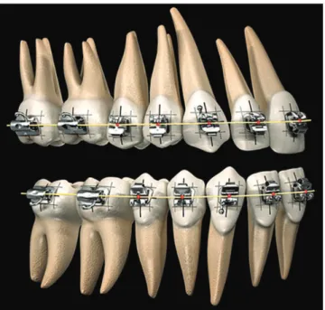 Figure 4 - Andrews ®  Plane: The surface or plane on which the mid trans- trans-verse plane of every crown in an arch will fall when the teeth are optimally  positioned