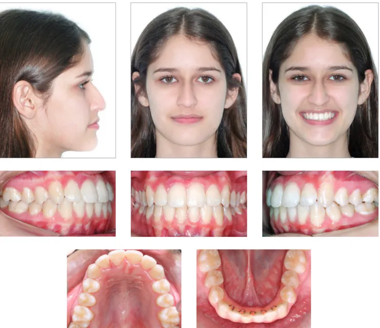 Figure 7 - Initial facial and intraoral photographs.