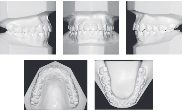 Figure 8 - Final casts.