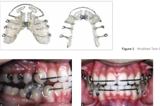 Figure 1 - Modified Twin Block appliance.