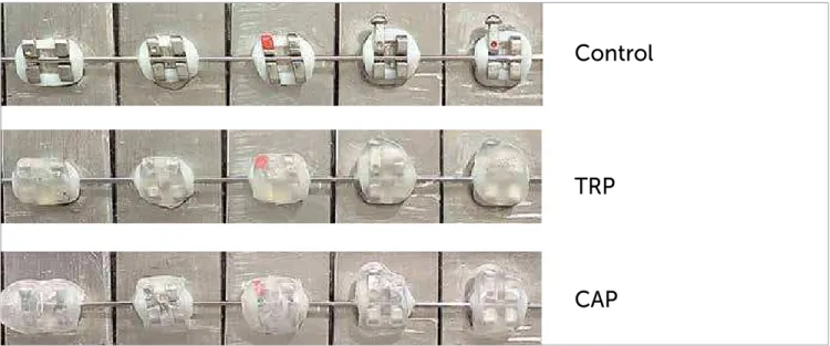 Figure 1 - Two systems containing protected brackets (CAP - customized acetate protector and TRP - temporary resin protector), and one system without  protected brackets (control).