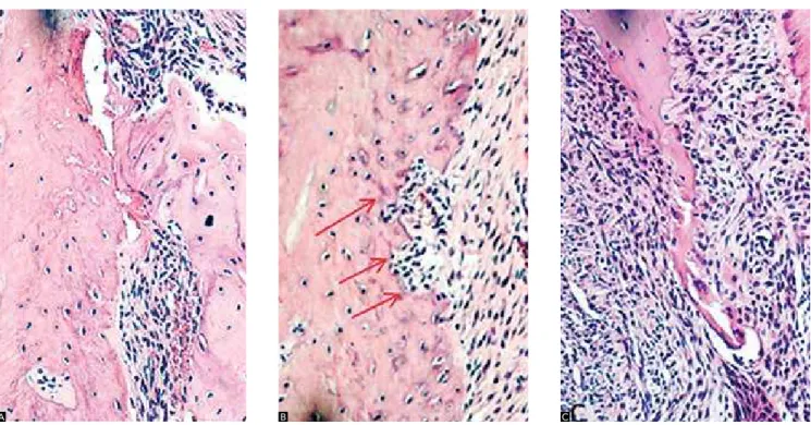 Figure 5 - Groups 7 and 8. A) Apical third of the root, hyaline areas - mag. 160x. B) Points of root resorption (middle third of the root - arrows) - mag