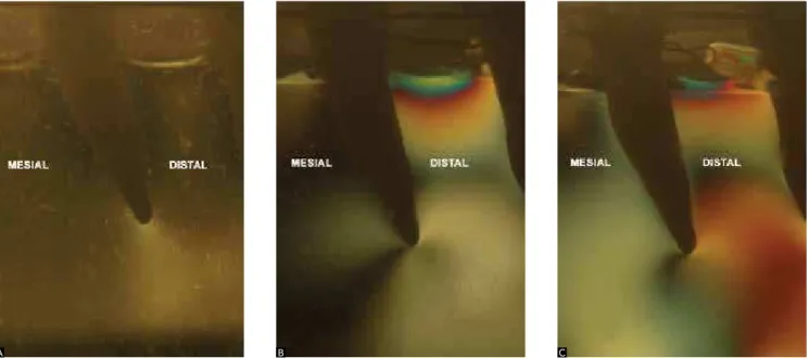 Table 3 shows the comparison between the fringe or- or-ders originating from retraction force associated with the  use of dental anchorage in the canine periradicular regions,  which was performed via the Kruskal-Wallis test  (signii-cance at P &lt; 0.05) 