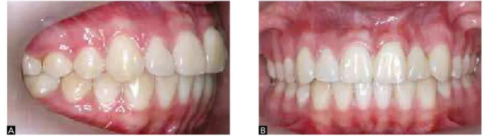Figure 15 - Final panoramic radiograph.
