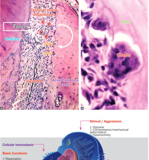 Figure 13 - The bone crest periodontal surface  of a tooth subject to induced tooth movement  reveals areas without osteoblasts, in addition to  stress and inflammation of ligament (asterisks)  at the periphery