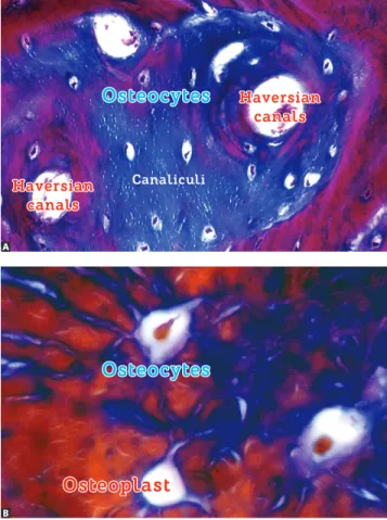 Figure 4 - Osteocytes and their typical shape,  with dozens of extensions forming an effective  network within the mineralized bone matrix