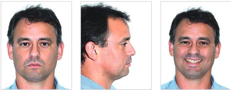 Figure 1 - Example of photograph set-up for diagnosis.