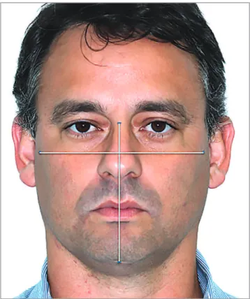 Table 1 - Facial index.