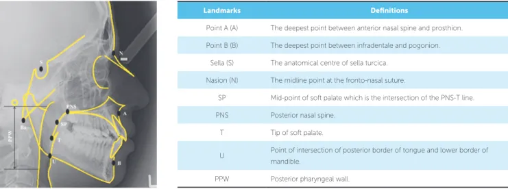 Figure 1 - Anatomical landmarks used for skeletal and pharyngeal analysis.